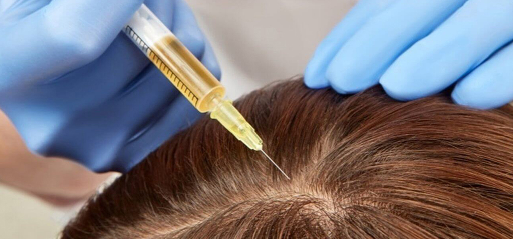 hair loss treatment
